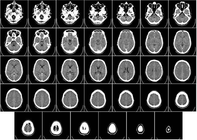 computer tomography 62942 640