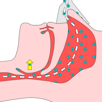 514px Schlafapnoe cpap.svg r2rhd0ojf4nz9fubxxnx0rd0tc32inzn0rrqy45hgg