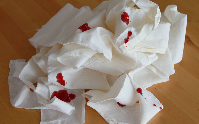 Cloth strips with blood   Public Domain