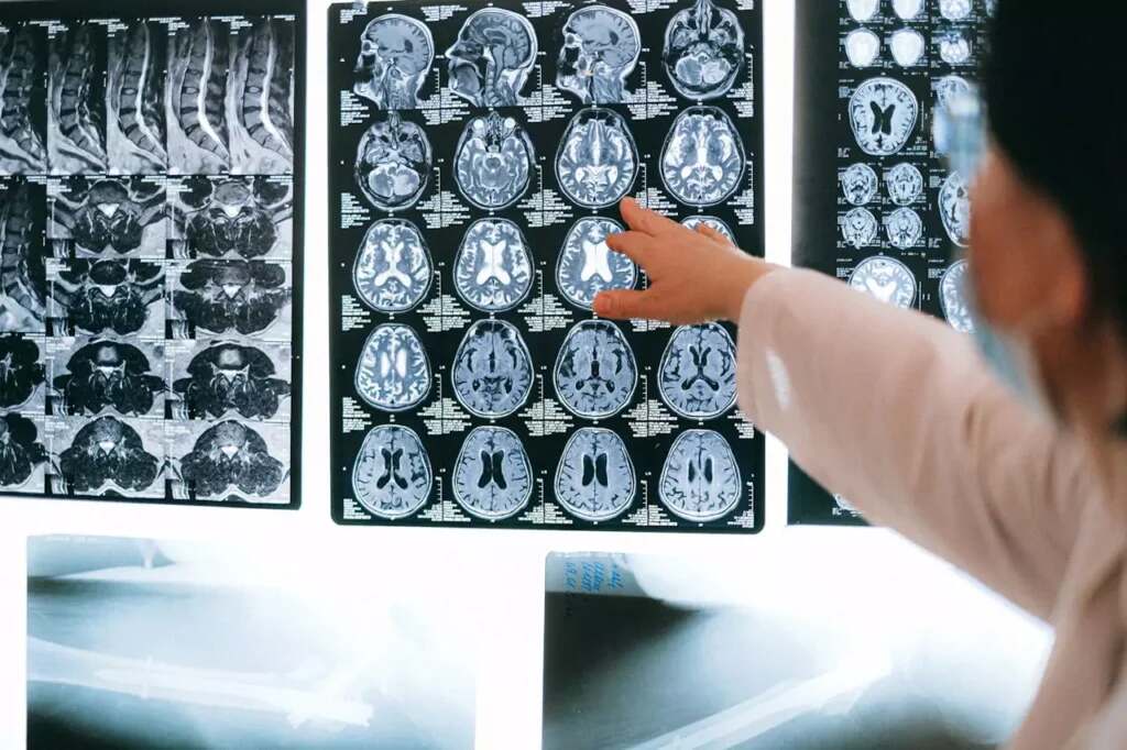Traumatic-Brain-Injury-Lawyers-1024x682