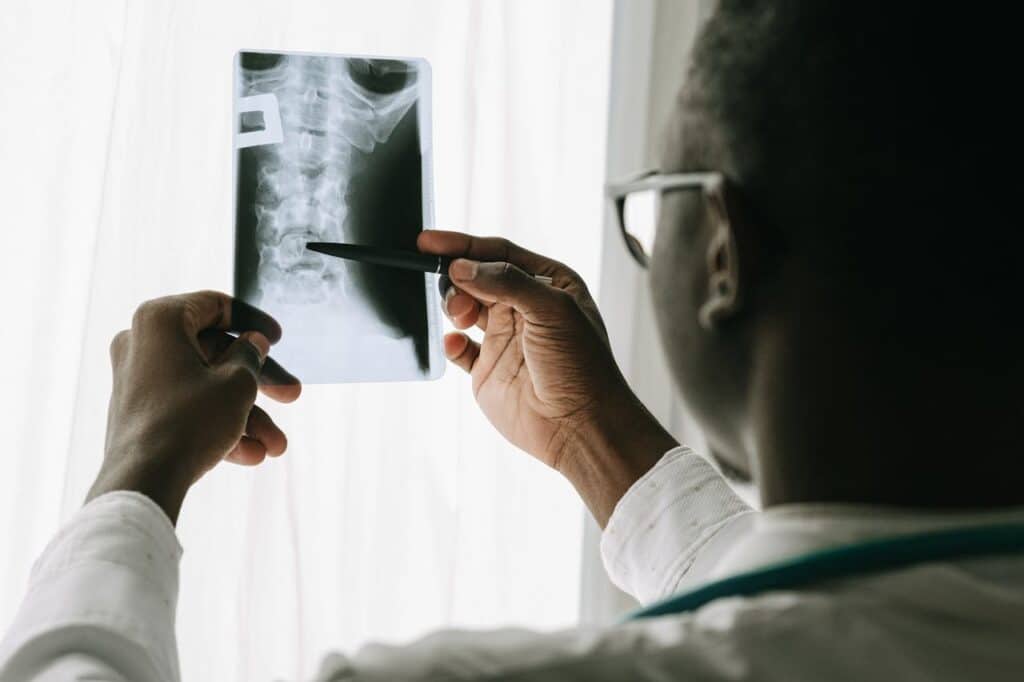 spinal cord injury lawyer