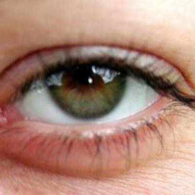 800px Eye opened close up 300x221