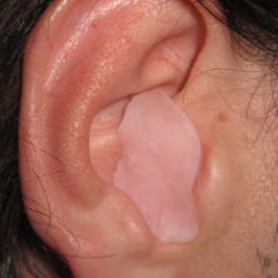 ear 196x300